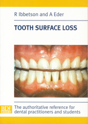 Toothwear book